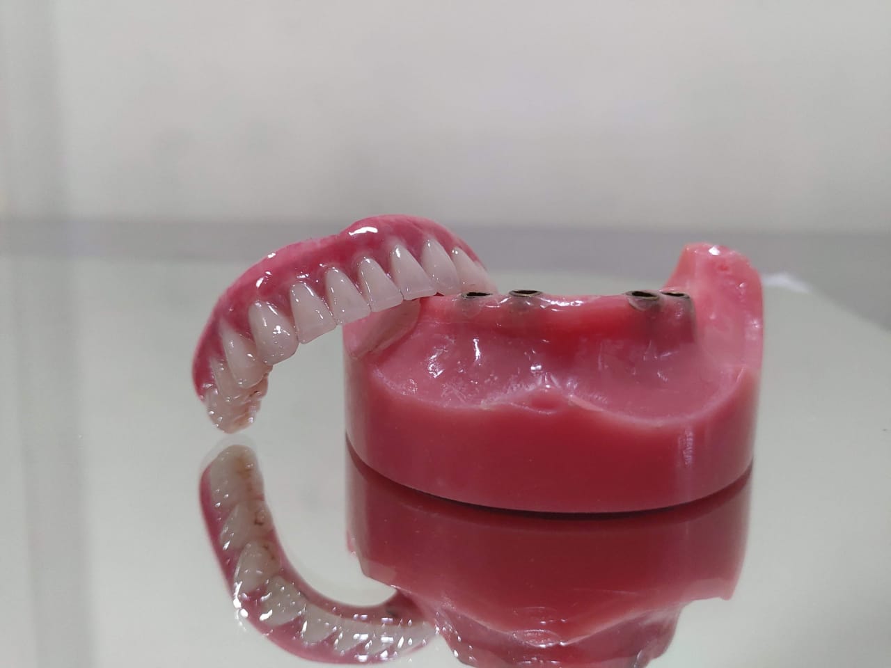 Hybrid Denture Pink City