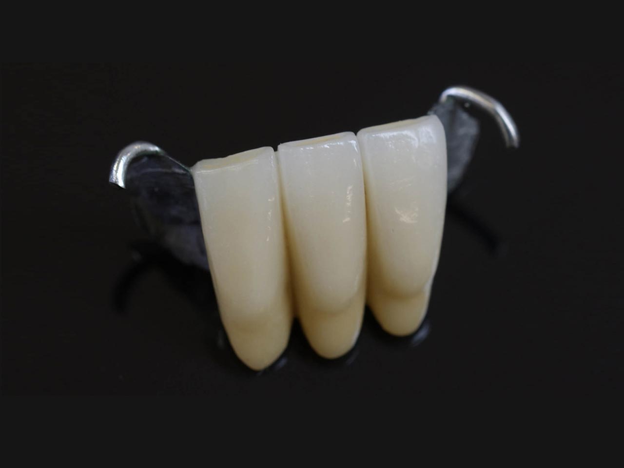 MARYLAND BRIDGE Pink City