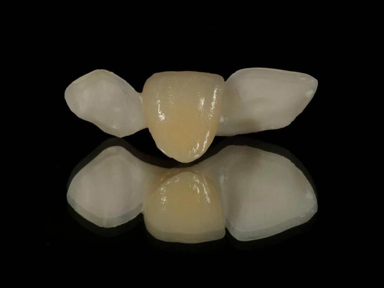 MARYLAND BRIDGE Pink City