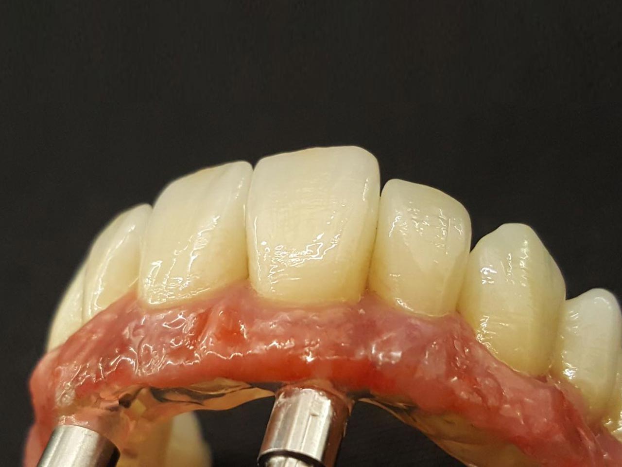 NexGraf Graphene Pink City