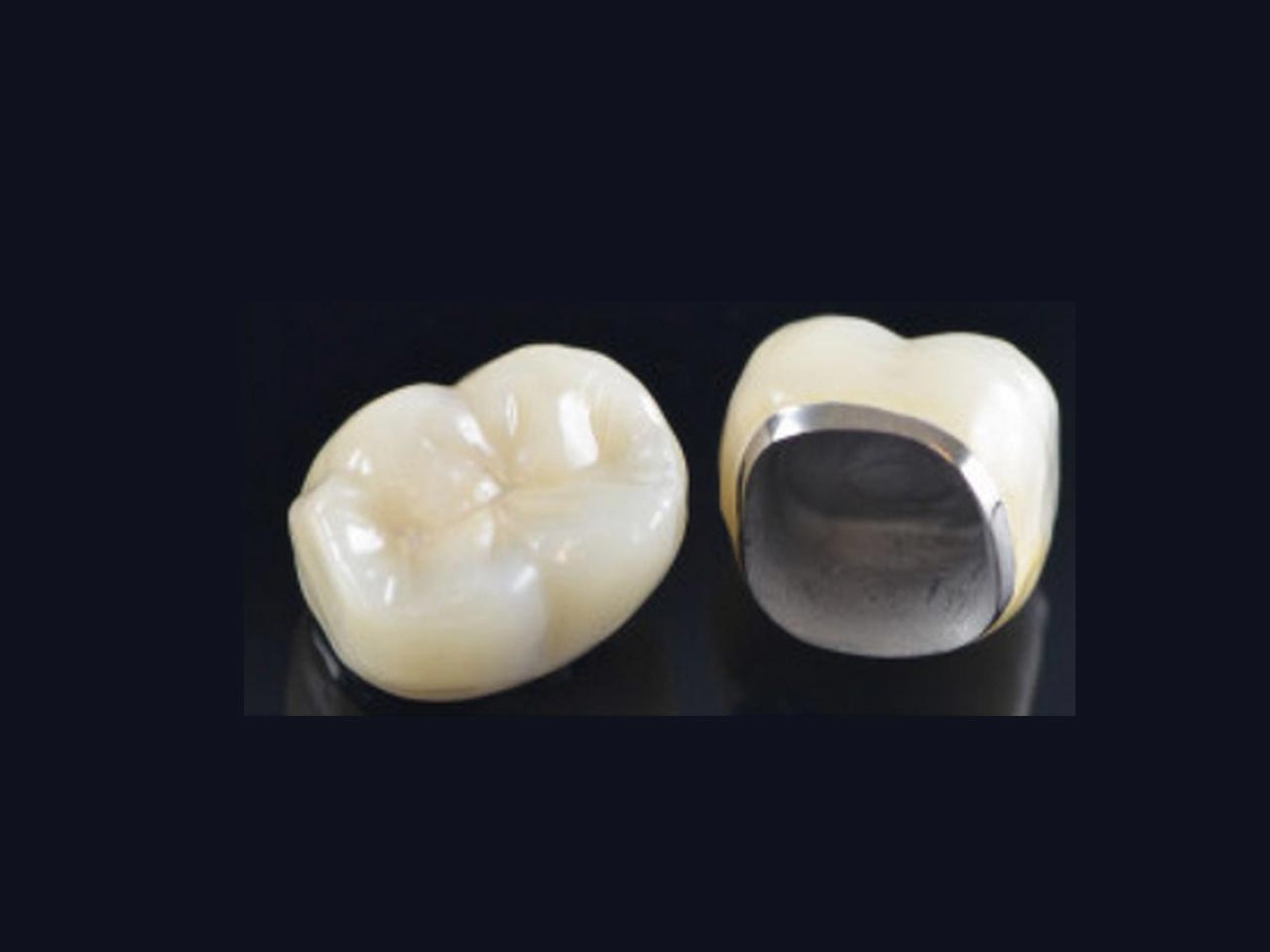 PFM Crown And Bridge Pink City