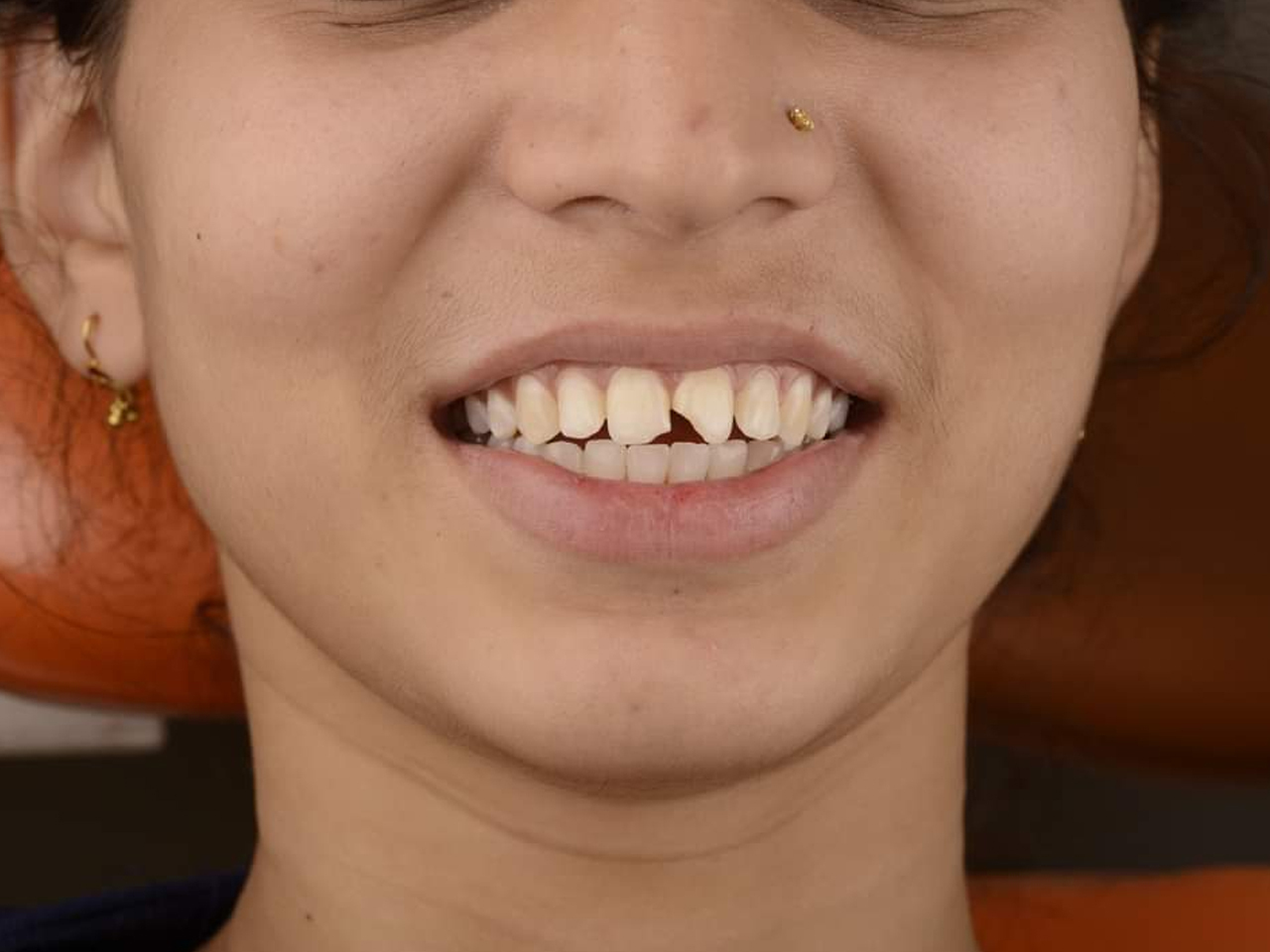 Case Gallery Pink City