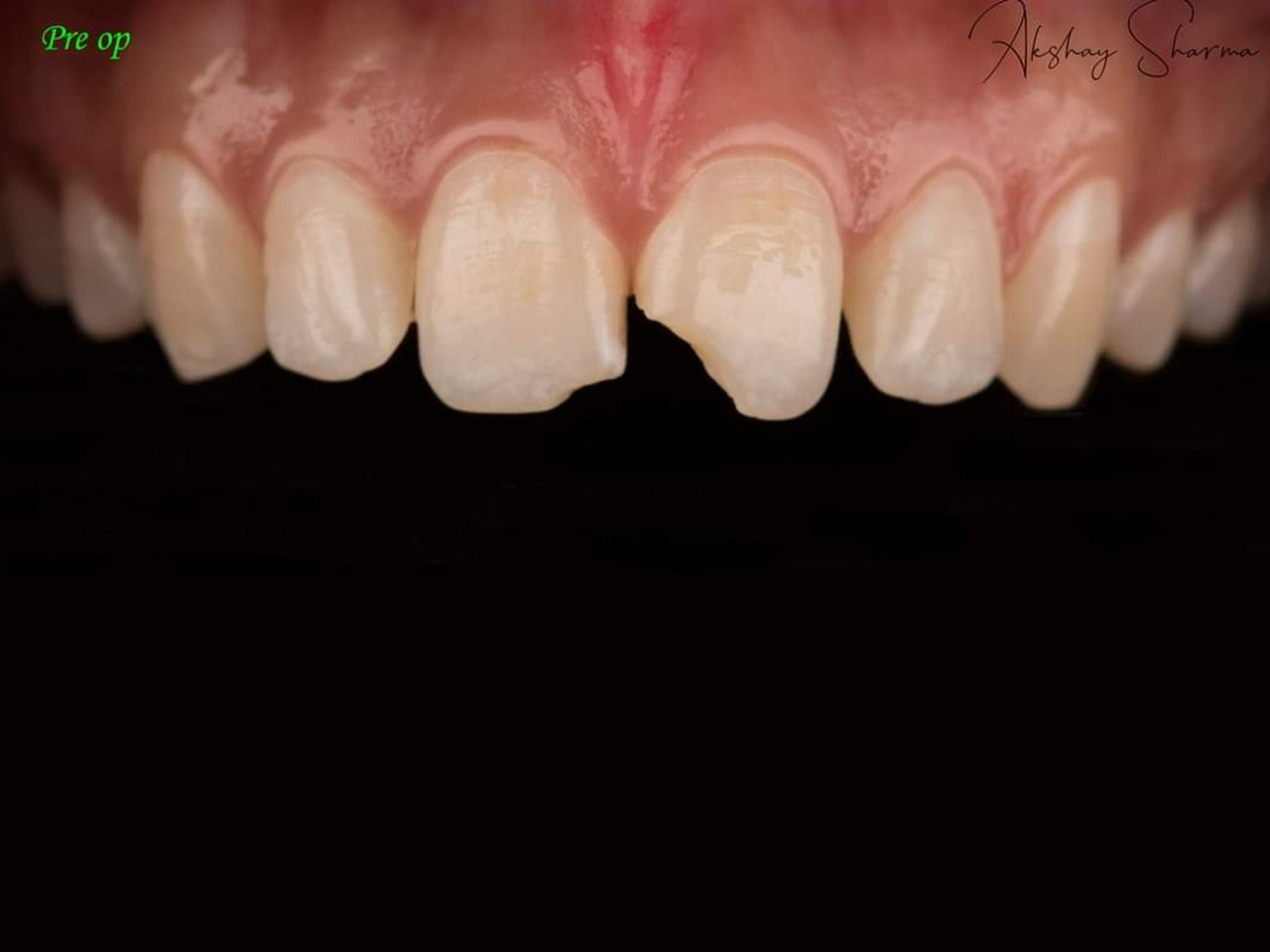 Case Gallery Pink City